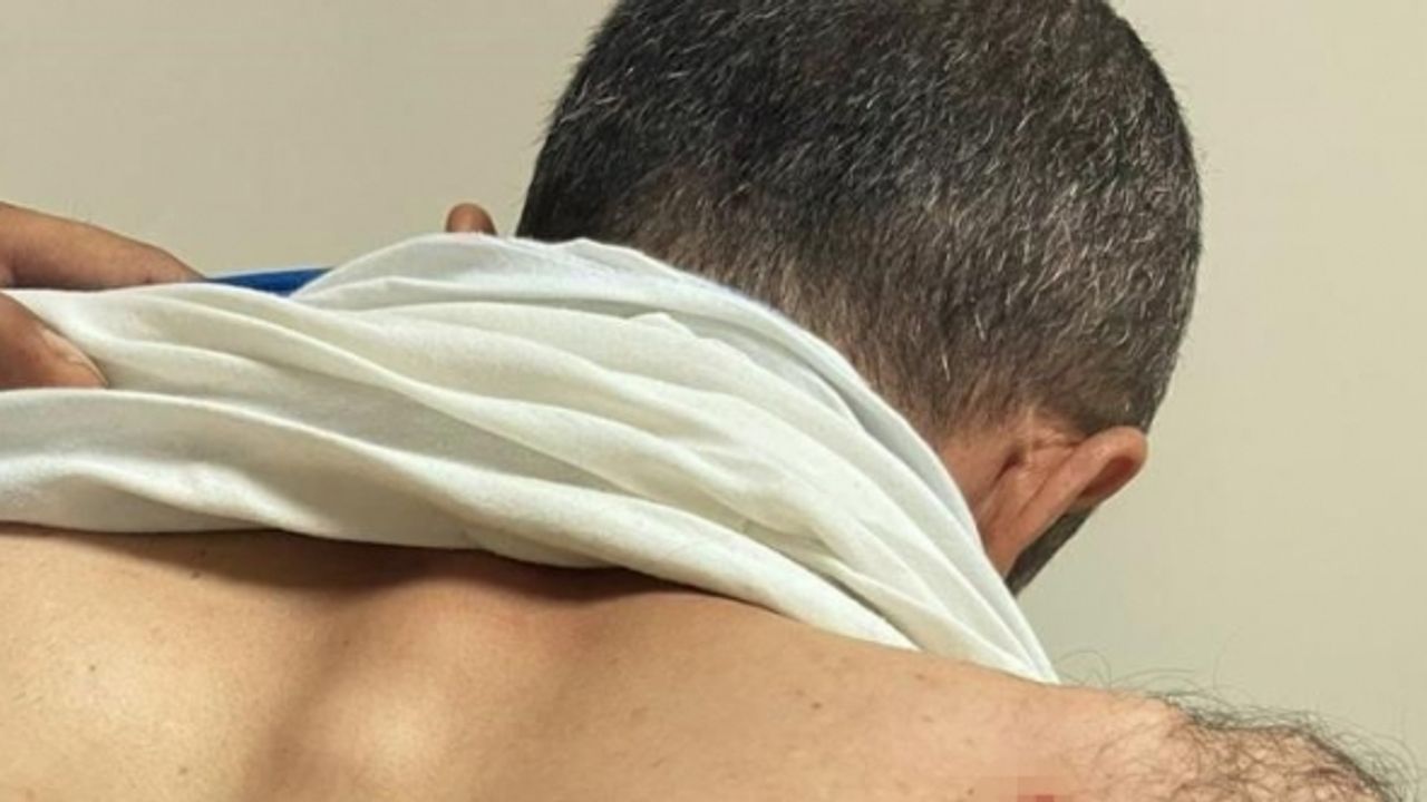 Siirt’te enerji şirketi saha ekibine saldırıda 2 personel yaralandı