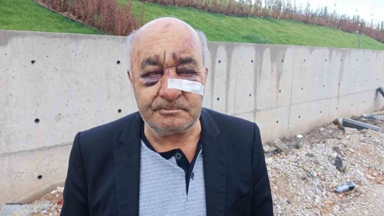 Öldüresiye dövülen taksici korku dolu o anları anlattı