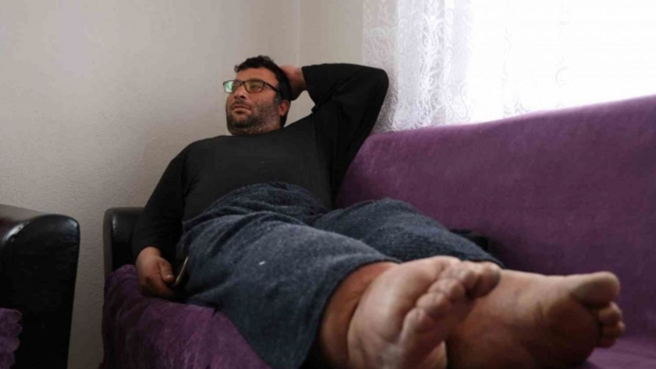 Bacakları 80 santimetre çapına ulaştı, hastalığın tedavisi yok