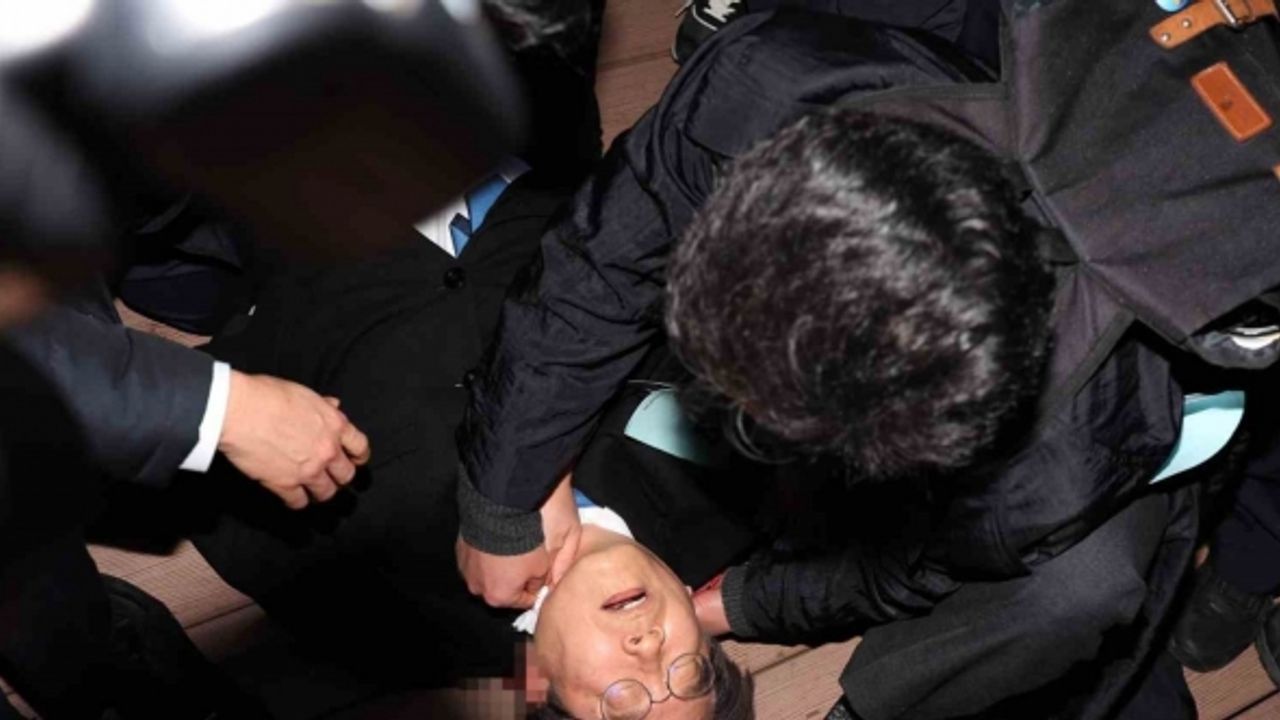 Güney Kore’de boynundan bıçaklanan ana muhalefet lideri ameliyat oldu