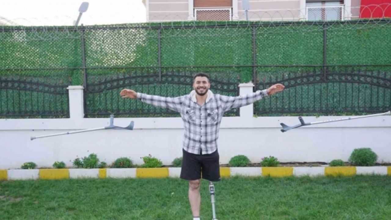 On sene sonra yürümenin mutluluğunu yaşıyor: Uçak bombasıyla kaybettiği bacağına protezle kavuştu
