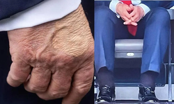ABD Başkanı Trump'ın Sağlığı Gündemde: Geri Dönüşü Olan Bir Alarm mı?