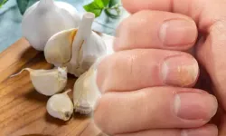 Doğal Mucize: Tırnak Mantarını Kısa Sürede Yok Eden 10 Etkili Yöntem