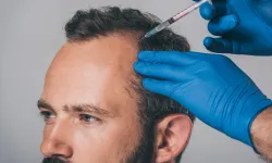 Troy Hair Turkey Hair Restoration Packages