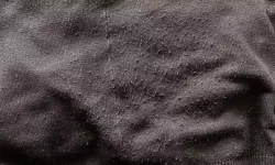 Kışlık Kazaklar Yeniden Parlıyor! Tiftik Sorununa Evde Pratik Çözümler