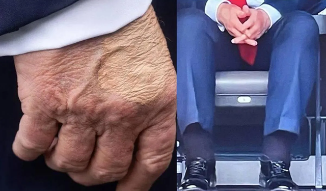 ABD Başkanı Trump'ın Sağlığı Gündemde: Geri Dönüşü Olan Bir Alarm mı?