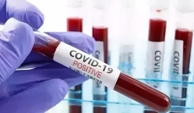 Covid-19 Vakaları Yeniden Tırmanışa Geçti: Uzmanlardan Kritik Uyarılar