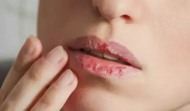 Oruçta En Çok Merak Edilen Soru: Dudak Yemek Orucu Bozar mı? İşte Diyanet’in Net Yanıtı